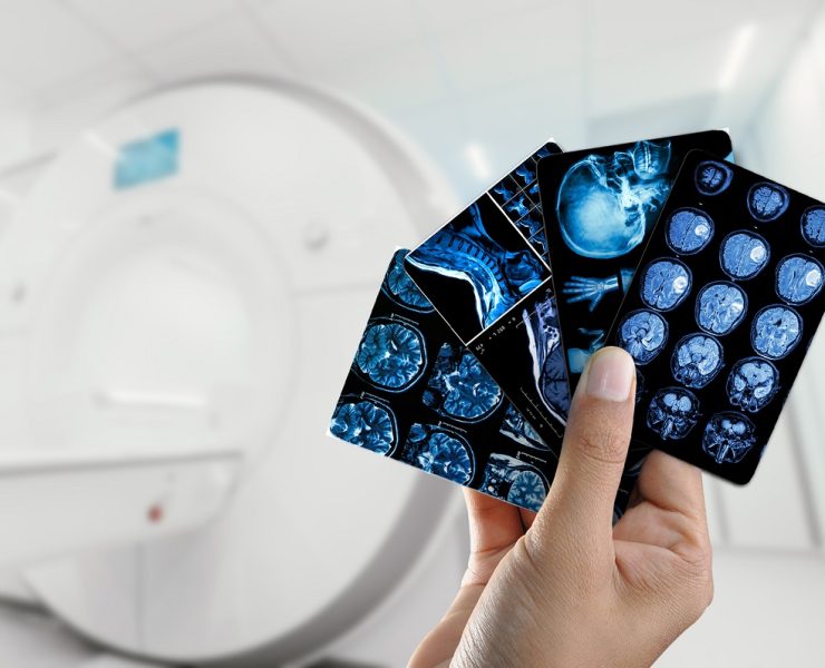 What Happens After Your Scan? A Look Inside the Radiologist’s Report