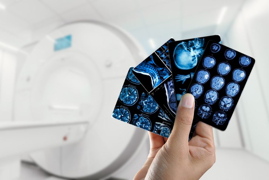 What Happens After Your Scan? A Look Inside the Radiologist’s Report